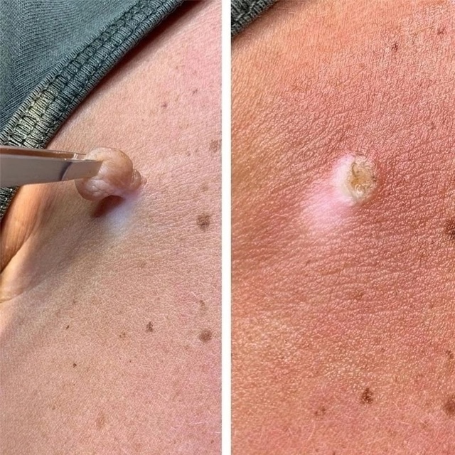 Сыворотка 22937776