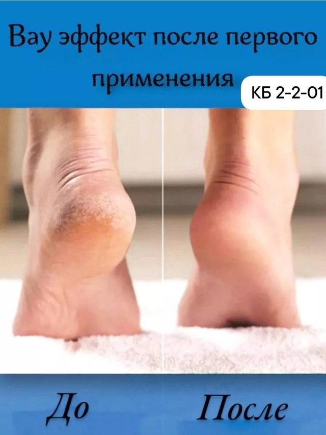 Нано терка для ног 22948710