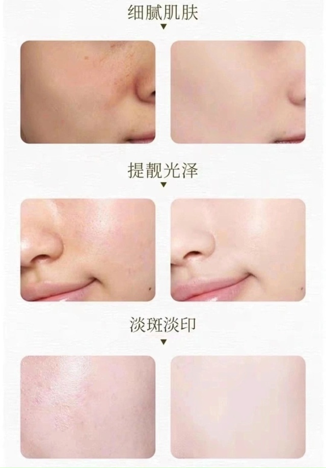 Сыворотка 23086079