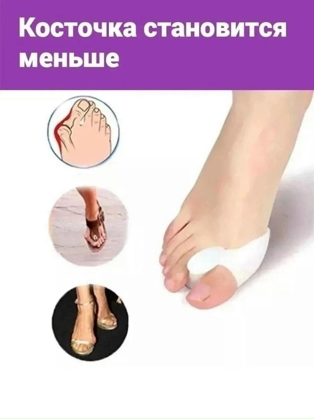 Бурсопротектор бандаж большого пальца 23143742